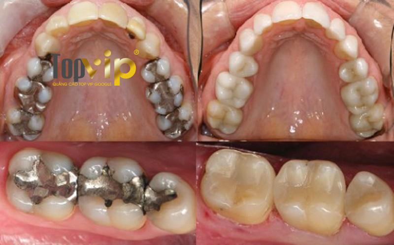 Kết quả rõ nét là minh chứng cho chất lượng đỉnh cao tại đây